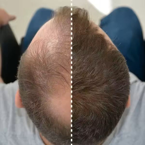 Fibra de pelo Negro 25 g